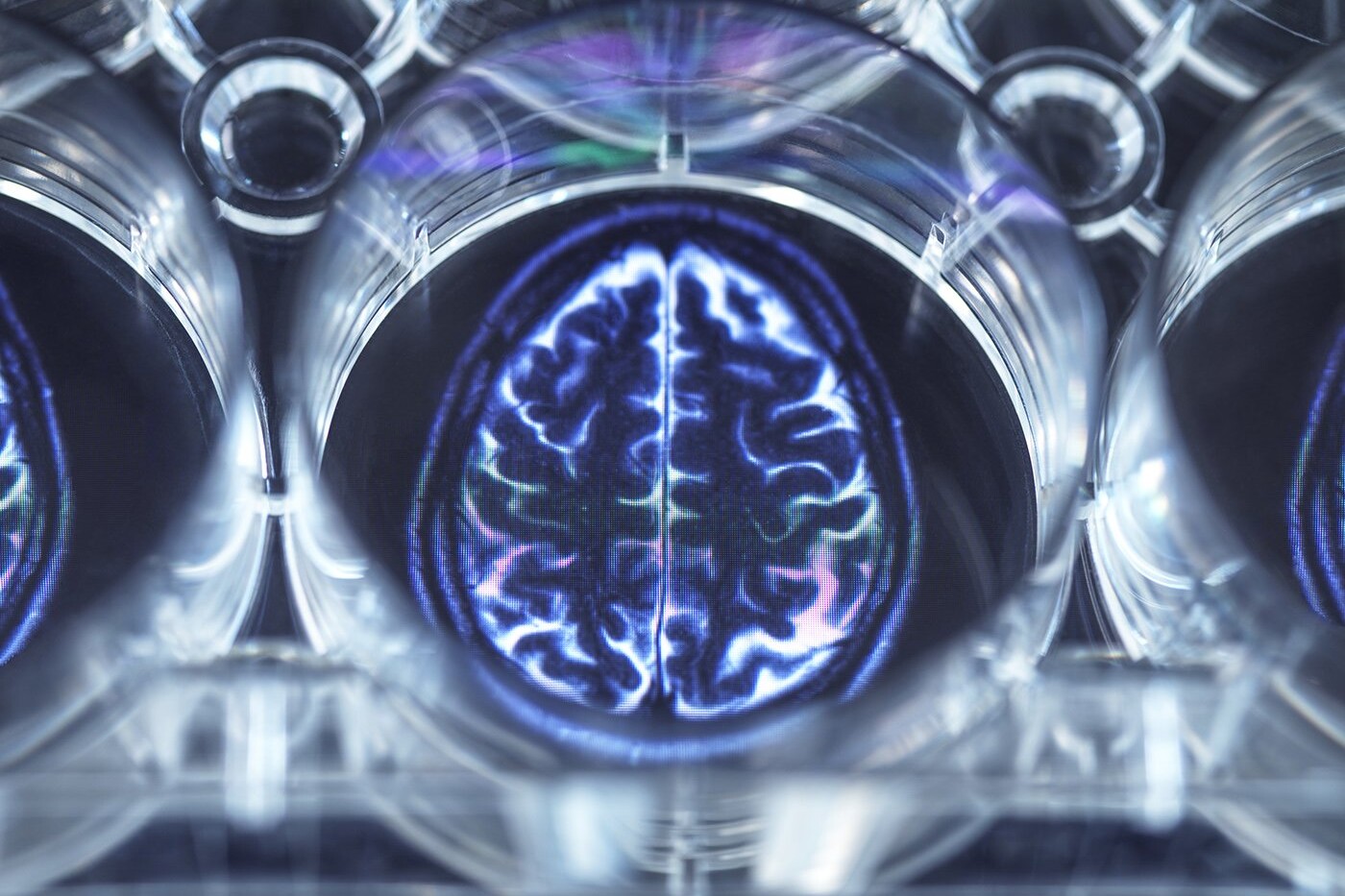 Peptides & the Brain: What Parents Should Know About This Emerging Area of Functional Medicine